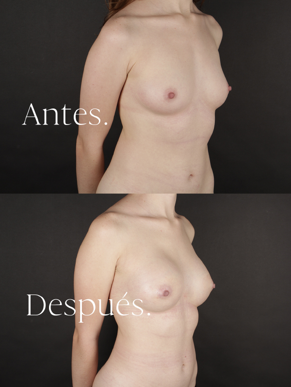 antes-y-despues