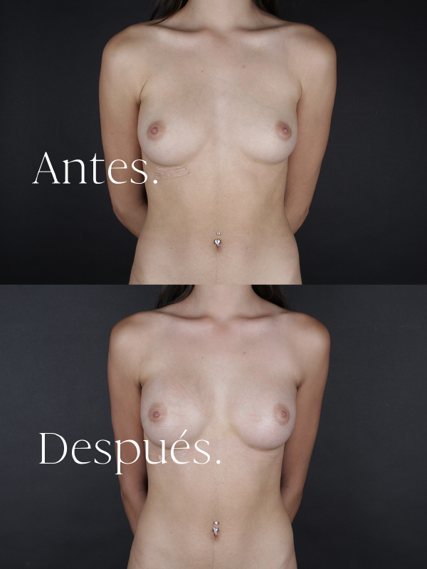 antes-y-despues